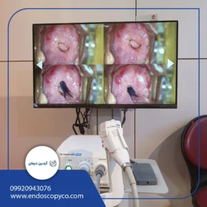 دستگاه کولپوسکوپی  سامتک