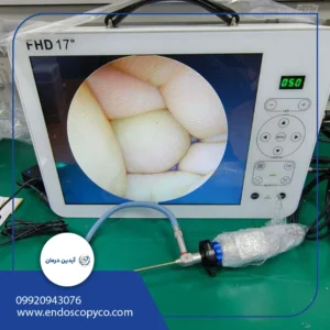 دستگاه لاپارسکوپی  هیستروسکوپی